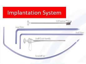 Implantation System